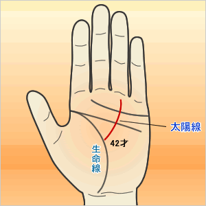 太陽線(薬指の下に出る線)